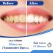 Lagunamoon Teeth Whitening Kit | 35% Urea Peroxide Gel with LED Light | No Sensitivity | Remove Coffee, Wine, Tea Stains - Buy Online on GoSupps.com
