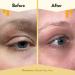 ECZEMA HONEY Multi Peptide Eye Cream - Anti Aging for Dark Circles & Puffiness - 0.5 Oz - Buy Online on GoSupps.com