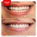 Colgate Max White Ultra Active Foam Teeth Whitening Toothpaste 75ml - Whitens Teeth in 3 Days, Enamel Safe Formula, Removes Deep Stains - Clinically Proven Fluoride Whitening Toothpaste - Buy Online on GoSupps.com