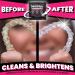 Retainer Cleaning Tablets - 120 Tablets (4 Months Supply) | Dentology Stain-Free Cleaner for Dentures, Aligners, Mouth Guard - Buy Online on GoSupps.com