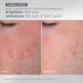 Dermalogica Warmth of the Winter Sun Travel Sized Skin Care Set Includes Face Exfoliants Facial Serum and Moisturizer with SPF - Buy Online on GoSupps.com