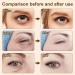 Snake Venom Eye Cream Chaffee Life Snake Venom Peptide Eye Serum Set for Firming and Anti-Wrinkle Treatment (4pcs) - Buy Online on GoSupps.com