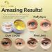 CUTESKINS 60 pcs Hydrogel Under Eye Patches with Collagen, 24K Gold, Vitamin C & Retinol - For Puffiness, Dark Circles, Fine Lines, Wrinkles & Anti-Aging - Buy Online on GoSupps.com