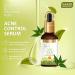Anti Acne Face Serum | Glycolic & 2% Salicylic Acid - 30ml for Clear Skin - International Shipping Available - Buy Online on GoSupps.com