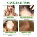 Rosemary Oil for Hair Growth - 59 ml Hair Care Oil (2 Pack) | Reduce Hair Loss & Nourish Scalp with Rosemary Mint Oil - Buy Online on GoSupps.com
