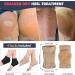 Cracked Heel Treatment Repair Socks - Premium Padded Compression Gel Sleeves for Dry Feet - 2 Pairs Spa Moisturizing Socks (One Size Fits Most - Buy Online on GoSupps.com