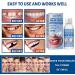 Temporary Tooth Filling Tooth Filling Repair Kit Tooth Repair Beads Missing Tooth Replacement Kit Moldable False Teeth for Fixing Filling Missing Broken Tooth Dental Repair Kit Filling for Fake Teeth - Buy Online on GoSupps.com