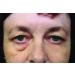 Rox Flawless Eyes by RX | Premium Eye Care for Radiant Skin | Shop Internationally Now - Buy Online on GoSupps.com