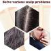 Lot de 3 peignes anti-pellicules peigne pour psoriasis du cuir chevelu l ger et l gant am liore la qualit des cheveux et lisse les cheveux pour les personnes ayant des cheveux longs et des - Buy Online on GoSupps.com