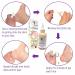 Vegan Foot Repair Cream & Callus Remover for Dry, Cracked Feet - Natural Exfoliating Gel for Thickened Skin | Non-Oily Formula with No Urea or Glycols - Buy Online on GoSupps.com