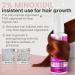 Remixidil Minoxidil 2% Hair Growth Spray for Women - Thinning Hair Regrowth & Thickening Treatment | Fast International Shipping - Buy Online on GoSupps.com