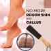 Eco Bath Natural Pumice Foot File for Men and Women - Callus & Dead Skin Remover with Wood Handle - Buy Online on GoSupps.com