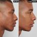The INKEY List Mandelic Acid Treatment - 10% Mandelic Acid for Hyperpigmentation & Post Breakout Marks - Buy Online on GoSupps.com