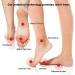 Superthotics Customizable Orthotic Inserts | Arch Support Insoles for Men 7.5-9 | Relieve Plantar Fasciitis & Pain - Buy Online on GoSupps.com