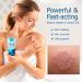 Roycederm Antifungal Cream for Tinea Versicolor, Athlete's Foot & Ringworm Treatment - Fast-Healing Multi-Functional Anti-Fungal Skin Cream - Buy Online on GoSupps.com