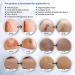 Puriderma Medical Silicone Scar Removal Sheets - Set of 5 | Fast & Effective on Keloid, Surgery, Burn, Acne, C-Section Scars - Buy Online on GoSupps.com