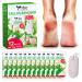 Feet Callus Remover Gel 12 Packs 8.4 oz with Pumice Stone Scrubber Kit for Professional Pedicure Remove Hard Skins Heels Callouses Jasmine Scent 12 Pack - Jasmine Scent