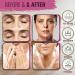 Medix 5.5 Retinol Cream & Hyaluronic Acid Lotion Set | Anti-Aging Moisturizer for Wrinkles & Dry Skin - 15 Fl Oz - Pack of 2 - Buy Online on GoSupps.com