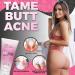 Pretty Privates Premium Buttocks Acne Cream - Salicylic Acid Clearing Lotion for Butt & Inner Thighs - 2 Oz - Buy Online on GoSupps.com