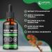 Natures Relief Co Itchy Scalp Treatment Serum - Instant Itch Alleviation | Dry Scalp Treatment - 100% Natural Ingredients - 50ml - Buy Online on GoSupps.com