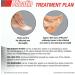 Micatin Cream for Athlete's Foot Jock Itch and Ringworm Antifungal and Antibacterial - Buy Online on GoSupps.com