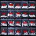 AORAEM Stiletto Nail Tips - 1000Pcs Acrylic False Nails Set with Bag (Short Clear+Natural) - Buy Online on GoSupps.com