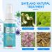 Natural Athlete's Foot Treatment Spray for Feet Itch, Sweat, Peeling & Blisters - Buy Online on GoSupps.com