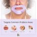 7E Wellness Conductive Lip Mask for Myolift - Portable Anti-Aging Skin Care Tool for Instant Face Lift & Tightening - Up to 10 Uses - Buy Online on GoSupps.com