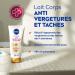 NIVEA Luminous630 Anti-Stretch Marks and Stains Body Lotion (1 x 200 ml) Anti-Spot Moisturizing Body Care 48 Hour Stretch Mark Reducer Women's Care for All Skin Types - Buy Online on GoSupps.com