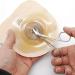 REMOS Stainless Steel Stoma Scissors for Precise Stoma Base Plate Cutting - Buy Online on GoSupps.com