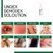 Ungex Basic Kit-i | Effective Demodex Solution for Acne Rosacea Itchiness & Redness - Shop Internationally - Buy Online on GoSupps.com