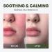 elravie HyCicaMue Ampoule | Lightweight Calming Serum for Sebum Control Pore Soothing & Barrier Care | Cica Hyaluronic Acid Vegan Mucin | Smooth & Fast-Absorbing Non Comedogenic | Korean Skin Care - Buy Online on GoSupps.com