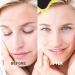 Forehead Wrinkle Patches - Anti-Wrinkle Hydrogel Patches for Smoothing Fine Lines | Collagen & Aloe Extract | 12 Pcs for All Skin Types - Buy Online on GoSupps.com