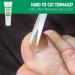 Toenail Softening Cream for Thick Hard Nails | Aloe Infused 1 Oz | Temporary Nail Care Solution - Shop Internationally - Buy Online on GoSupps.com