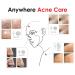 AX Acne Hydrocolloid Pimple Patch Bandage Variety Pack | Skincare Spot Treatment for Clearing Pores and Blemishes - Buy Online on GoSupps.com