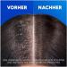  Head & Shoulders Head & Shoulders For Men Anti-Dandruff Shampoo Up to 100% Dandruff Protection for Hair and Scalp Clinically Confirmed Dermatologically Tested 300 ml - Buy Online on GoSupps.com