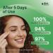 BetterLids Eyelid Cleansing Gel Gentle Centella & Tea Tree Extract Cleanser Refreshes & Cleanses for Daily Eyelid Care Preservative-Free 1.06 oz - Buy Online on GoSupps.com
