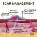 Epi-Derm Large Silicone Scar Sheet - 11 x 15.75 in - Natural - Biodermis - Buy Online on GoSupps.com