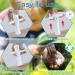 Allinko Venom Extractor Bee/Wasp Sting Suction Pump - Bite Relief for Hiking, Backpacking, Camping - Reduce Pain & Swelling, No Odor, 1PCS - Buy Online on GoSupps.com