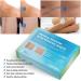 Puriderma Medical Silicone Scar Removal Sheets - Set of 5 | Fast & Effective on Keloid, Surgery, Burn, Acne, C-Section Scars - Buy Online on GoSupps.com
