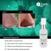 Lauda Botanicals Blackhead Remover Cleanser with Salicylic Acid - 1 Ounce - Buy Online on GoSupps.com