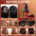Batana Oil Shampoo et Apr s-shampooing pour la Croissance et la Pr vention de la Chute des Cheveux - Nourrissant pour Cuir Chevelu Sec Shampooing et apr s-shampooing Sets - Buy Online on GoSupps.com