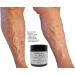 Varicose Veins Balm 120ml - Treatment for Varicose, Spider Veins, Acne, Stretch Marks - Buy Online on GoSupps.com