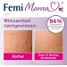 tetesept Femi Mama Stretch Marks Intensive Cream - Reduce & Prevent Stretch Marks - 100 ml - International Shipping Available - Buy Online on GoSupps.com