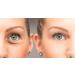 Su-Skin Anti Aging Eye Cream Bright Eyes Daily Wrinkle Cream for Dark Circles & Puffiness | Firming Eye Treatment for Youthful Skin - Buy Online on GoSupps.com