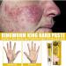G-SHOTOY Revitaskin Eczema Cure Cream - Relief and Treatment for Adults with Psoriasis - Healthy Skin Treatment (2pcs) - Buy Online on GoSupps.com