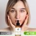 OnPoint Organic Marula Facial Oil - Cold-Pressed Vegan Anti-Aging Moisturizer | Gluten-Free Ultimate Skin Hydration (30 mL - Buy Online on GoSupps.com