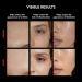 FAQ 202 Smart Anti Aging NIR + 7 LED Face Light Therapy Mask + Microneedling Anti-Wrinkle Hyaluronic Acid Patches for Under Eyes & Forehead - Face Masks Skincare - Wireless Wearable Skin Care - Buy Online on GoSupps.com