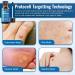 Treatonic Wart Remover Gel - Fast Acting Plantar Wart Removal for Feet - Suitable for All Skin Types - Buy Online on GoSupps.com