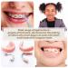 Interdental Brushes & Tooth Stain Remover Kit - 12 Piece Set for Implants and Detail Cleaning - Buy Online on GoSupps.com